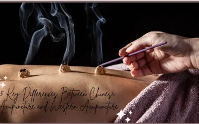 4 Key Differences Between Chinese Acupuncture and Western Acupuncture