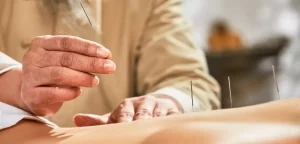 Western acupuncture